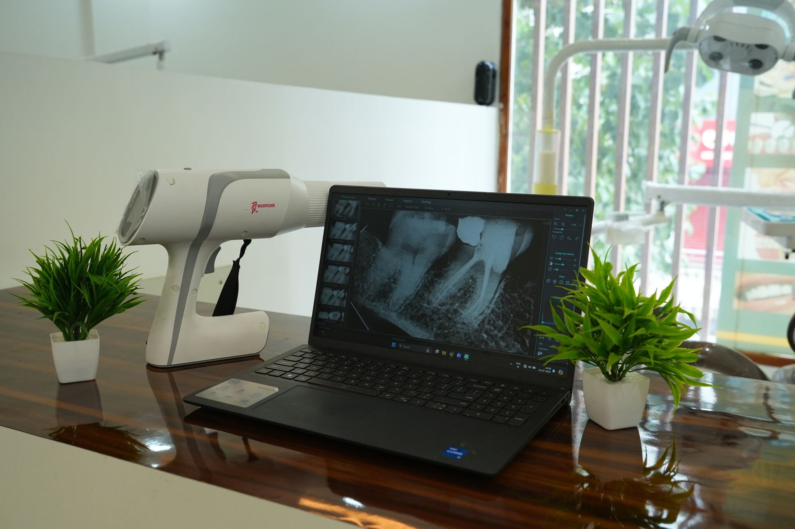 Digital X-ray shown on a laptop at Pristine Dental Clinic, HSR Layout